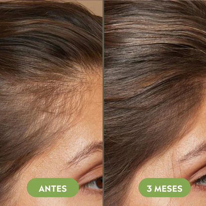 Aceite natural para el crecimiento del cabello